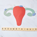 Endometrioza Dhe Shëndeti Mendor